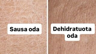 Sausa ar dehidratuota oda – kaip atskirti?