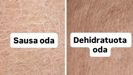 Sausa ar dehidratuota oda – kaip atskirti?